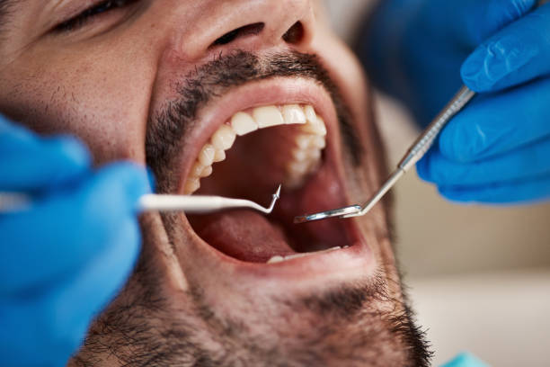 Best Orthodontic Emergency Dentist in Tipton, MO